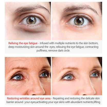 ELLEN ELLA Advanced Eye Cream-Remove Dark Circles, Eye Bags, Wrinkles-Make you 20 years younger✅ 7-Day Improvement Guarantee – Full Refund if No Results