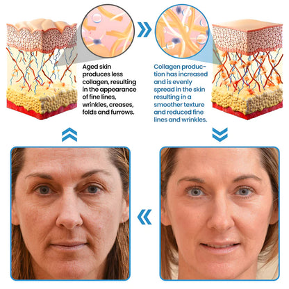 Biancat® Collagen Peptide Serum✅ 7-Day Improvement Guarantee – Full Refund if No Results