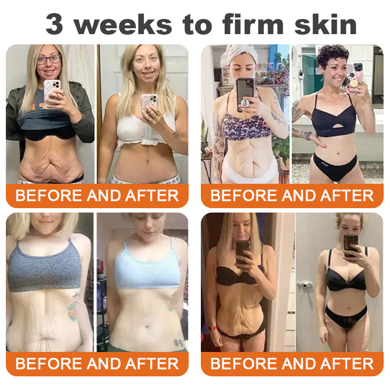 ✨Flysmus™ Botox Bee Venom Firming Serum Stick👩‍🔬✅ 7-Day Improvement Guarantee – Full Refund if No Results