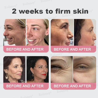 ✨Rolimey® Bio-Botox PDRN Collagen Wrinkle Stick – Lift, Firm & Smooth Skin with Salmon DNA & Plant-Based Bakuchiol✅ 3-Day Improvement Guarantee – Full Refund if No Results