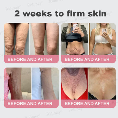 ✨Rolimey® Bio-Botox PDRN Collagen Wrinkle Stick – Lift, Firm & Smooth Skin with Salmon DNA & Plant-Based Bakuchiol✅ 3-Day Improvement Guarantee – Full Refund if No Results