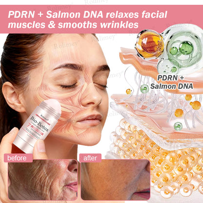 ✨Rolimey® Bio-Botox PDRN Collagen Wrinkle Stick – Lift, Firm & Smooth Skin with Salmon DNA & Plant-Based Bakuchiol✅ 3-Day Improvement Guarantee – Full Refund if No Results