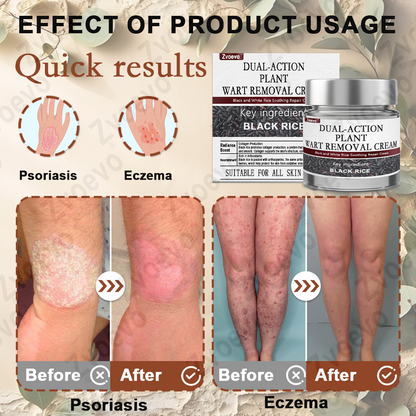 Zvoevo® Black Rice Skin Repair Essence Cream ⚕️ FDA Certified (Removes warts and skin growths, improves keratin buildup and seborrheic dermatitis, follicular keratosis, age spots, and bruising)
