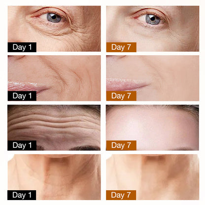 ELLEN ELLA Advanced Eye Cream-Remove Dark Circles, Eye Bags, Wrinkles-Make you 20 years younger✅ 7-Day Improvement Guarantee – Full Refund if No Results