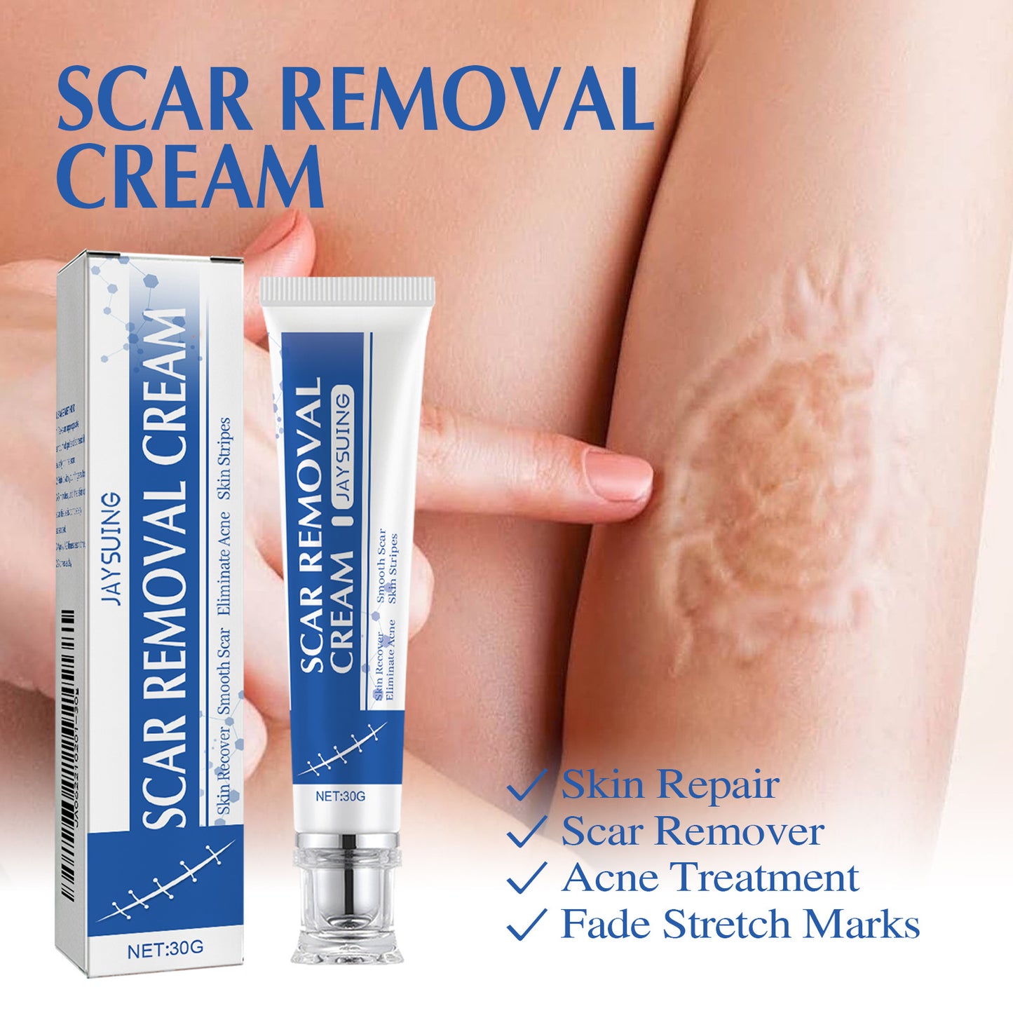 👩‍🔬 Advanced Scar Removal Gel✅ 7-Day Improvement Guarantee – Full Refund if No Results