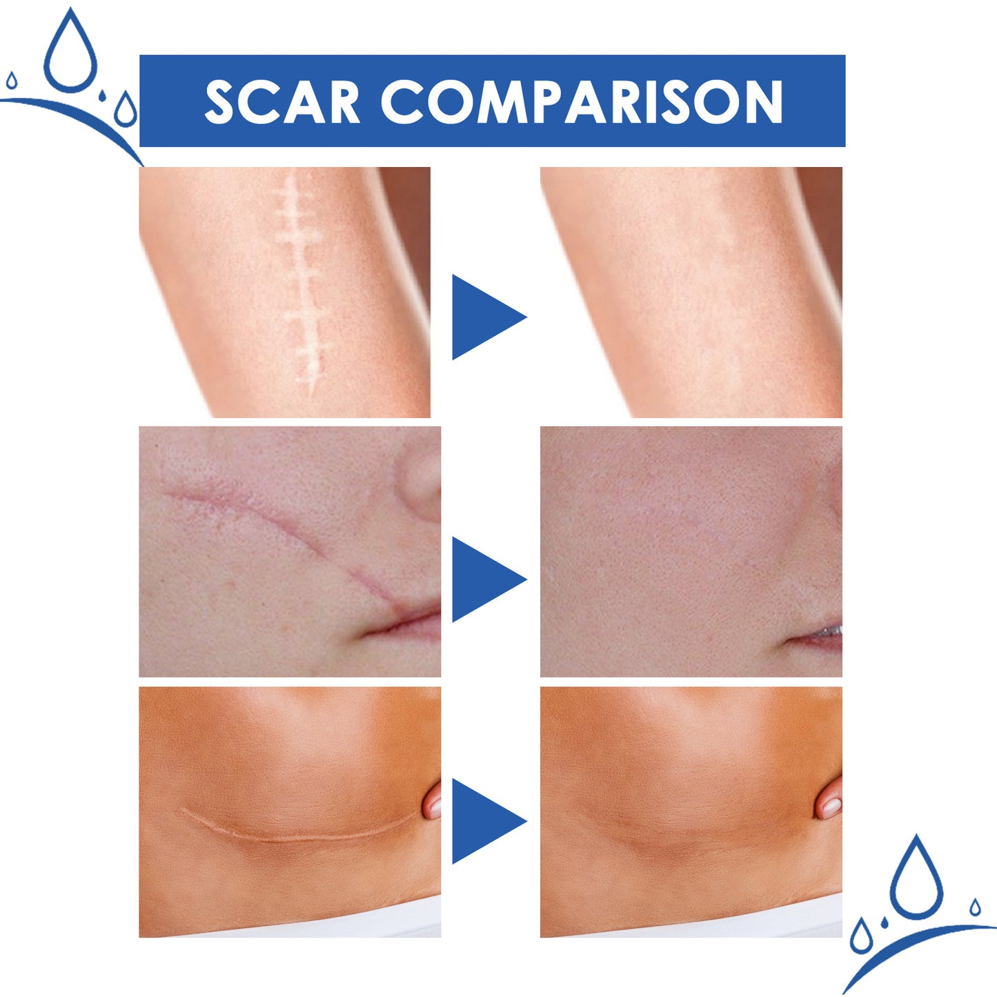 👩‍🔬 Advanced Scar Removal Gel✅ 7-Day Improvement Guarantee – Full Refund if No Results
