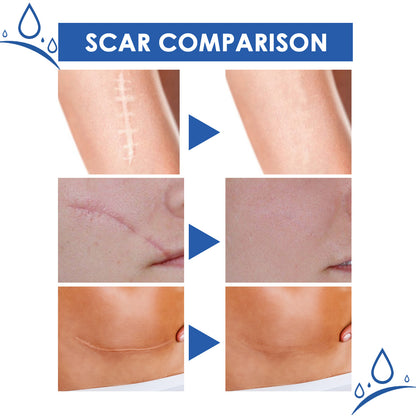 👩‍🔬 Advanced Scar Removal Gel✅ 7-Day Improvement Guarantee – Full Refund if No Results