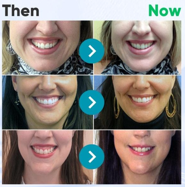 Rolimey® VioCore Bee Venom Dental Treatment Toothpaste✅ 7-Day Improvement Guarantee – Full Refund if No Results