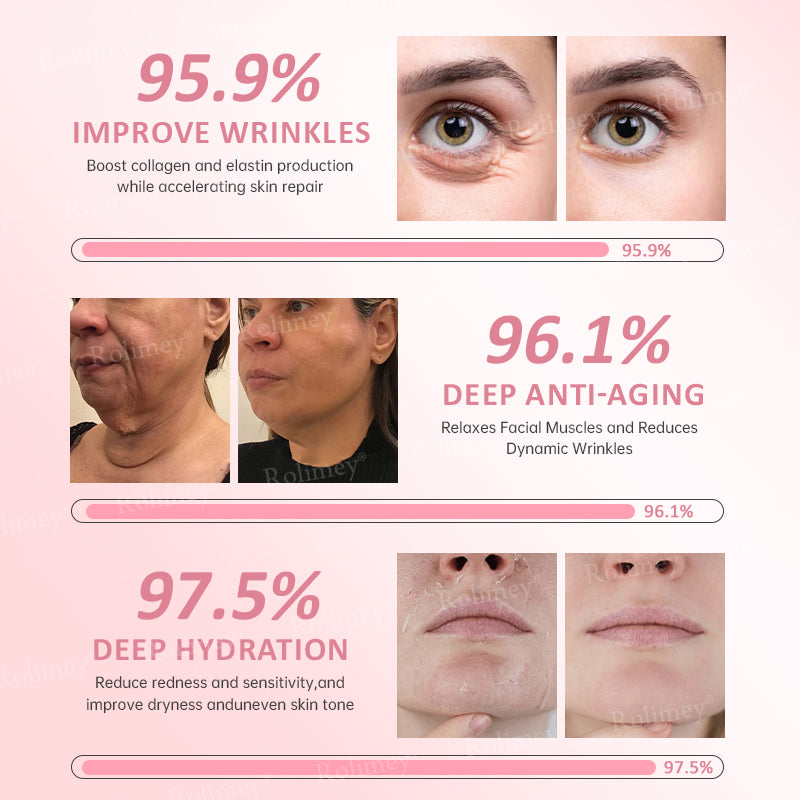 ✨Rolimey® Bio-Botox PDRN Collagen Wrinkle Stick – Lift, Firm & Smooth Skin with Salmon DNA & Plant-Based Bakuchiol✅ 3-Day Improvement Guarantee – Full Refund if No Results