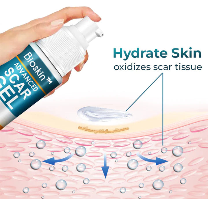 👩‍🔬Bioskin™ Advanced Scar and Stretch Marks Removal Gel✅ 7-Day Improvement Guarantee – Full Refund if No Results