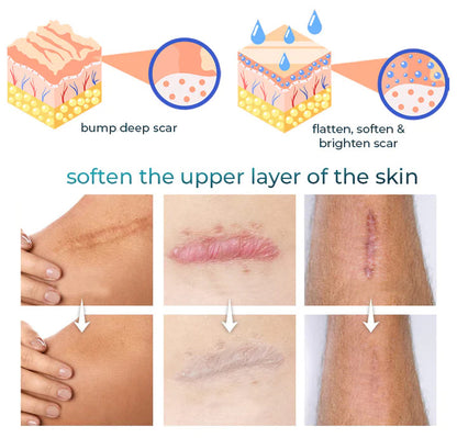 👩‍🔬Bioskin™ Advanced Scar and Stretch Marks Removal Gel✅ 7-Day Improvement Guarantee – Full Refund if No Results