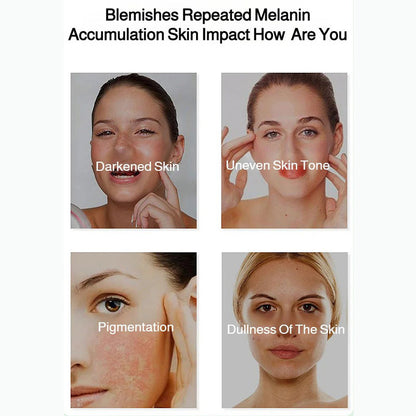 🎉Radiant Skin & Spot Correcting Spray💦✅ 7-Day Improvement Guarantee – Full Refund if No Results