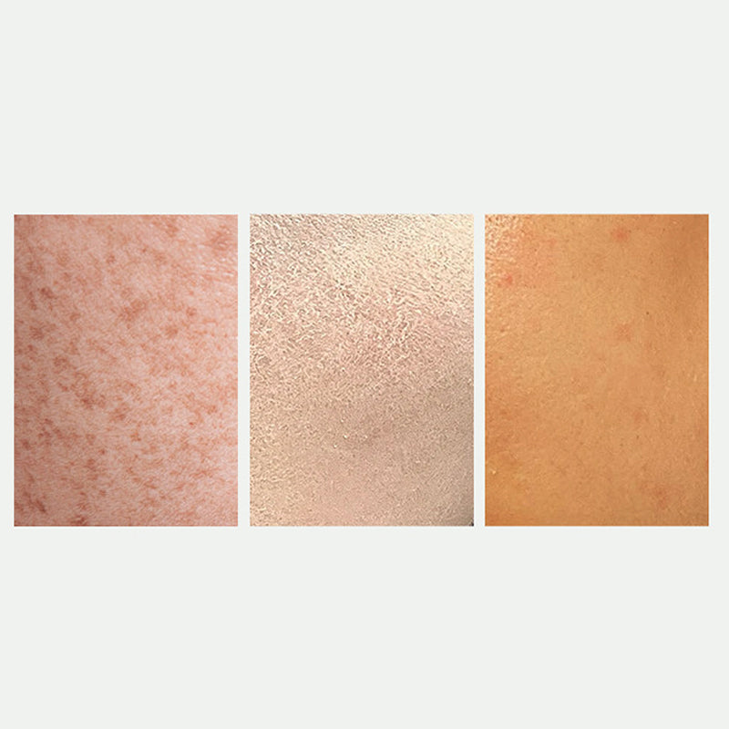 🎉Radiant Skin & Spot Correcting Spray💦✅ 7-Day Improvement Guarantee – Full Refund if No Results