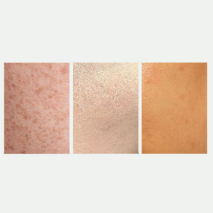 🎉Radiant Skin & Spot Correcting Spray💦✅ 7-Day Improvement Guarantee – Full Refund if No Results